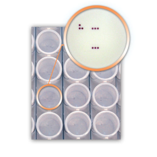 Kit di test per malattie infettive - DA4270 - AID , Autoimmun Diagnostika   - HPV / del papillomavirus umano / faringeo