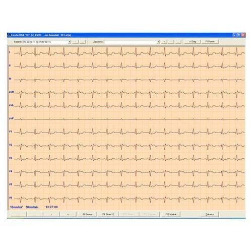 Software per elettrocardiografia - CARDIOTEKA v.211SOFTHL7 - ASPEL  - visualizzatore / di cuore / in linea