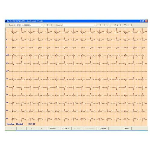 Software per elettrocardiografia - CARDIOTEKA v.211SOFT - ASPEL  - diagnostico / di monitoraggio / di cuore