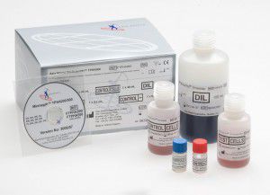 Test rapido della sifilide - FTPHA200 - Axis-Shield PLC  - del Treponema pallidum / di siero / al plasma
