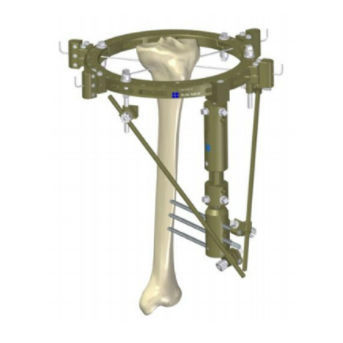 Fissatore esterno per tibia - 549.10 - BAUMER  - ibrido / per adulti