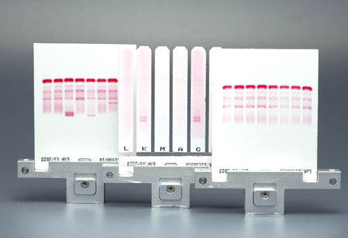 Reagente di siero - CELL - Start Project  - antisiero / per elettroforesi / diagnostico