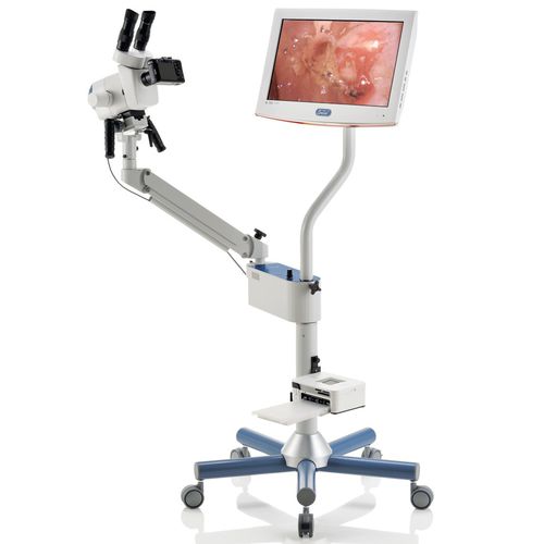 Videocolposcopio - Z4 - Centrel   - binoculare / su carrello