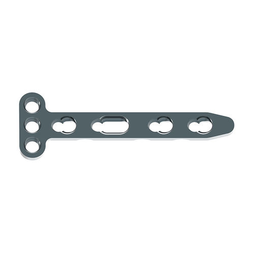 Placca di compressione per radio - 70904 series - Waston medical - distale / bloccata / in titanio