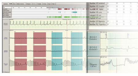 Software diagnostico - Compumedics - di monitoraggio / per polisonnografia