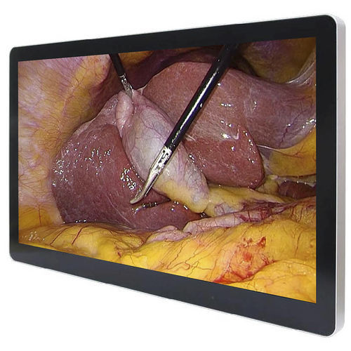 Monitor medico - ECONT-0501.7 - Contact Co. - chirurgico / 4K / 43"