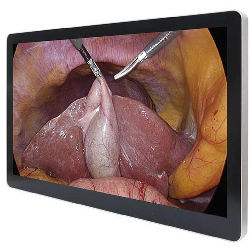 Monitor medico - ECONT-0501.3 - Contact Co. - chirurgico / Full HD / 27"
