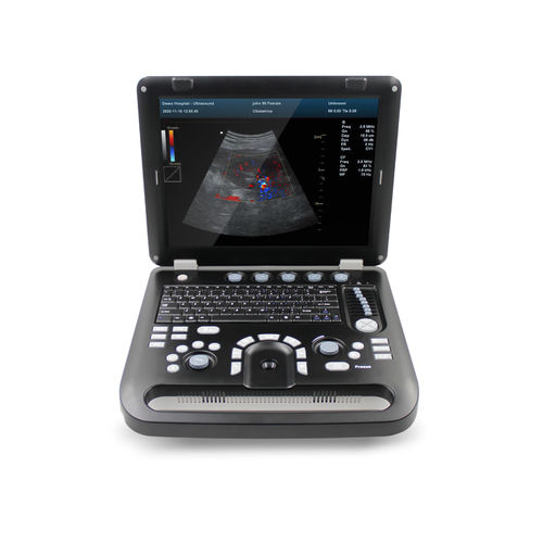 Ecografo portatile - CMS1700A  - Contec Medical Systems - per ecografia multidisciplinare / per ecografia ginecologica ed ostetrica / per ecografia addomino-pelvica