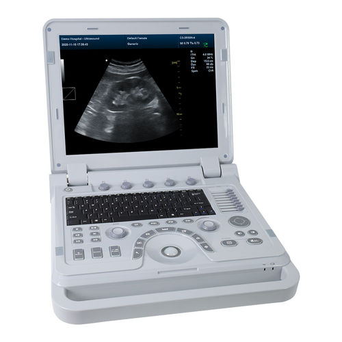 Ecografo veterinario portatile - CMS1700A-VET - Contec Medical Systems - multiuso / in bianco e nero / con doppler a colori