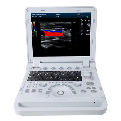 ecografo portatile - Contec Medical Systems