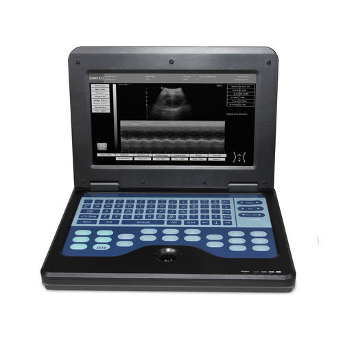 Ecografo portatile - CMS600P2  - Contec Medical Systems - per ecografia ginecologica ed ostetrica / per ecografia urologica / per ecografia cardiovascolare
