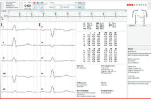 Algoritmo diagnostico - ECG algorithms - Corscience GmbH & Co. KG - di analisi / per ECG