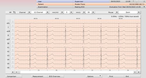 Modulo software per elettrocardiografia - custo med GmbH - per prova da sforzo / per test di riposo / di analisi