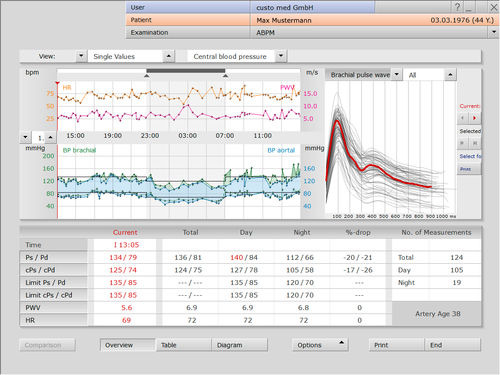 Modulo software per monitor della pressione arteriosa - custo med GmbH - di analisi / diagnostico / di valutazione