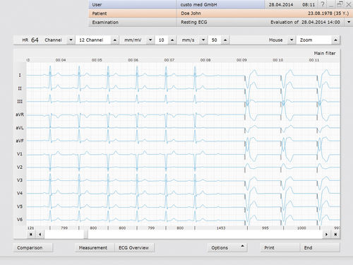 Software diagnostico - custo med GmbH - di gestione / di scambio dati / di telemonitoraggio