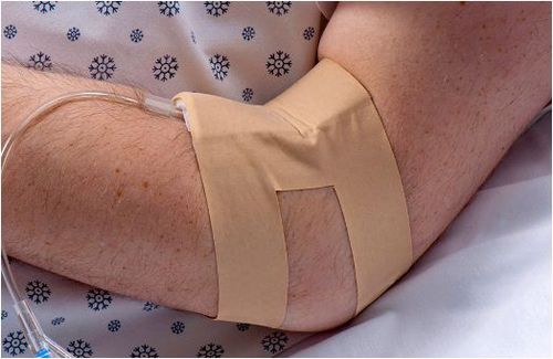 Fissatore per catetere intravenoso - IV-ARMOR®  - Dale Medical Products - per braccio / adesivo