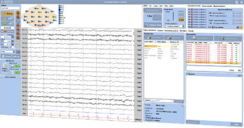 Software per EEG - DEYMED Diagnostic - di acquisizione / di interpretazione / visualizzatore