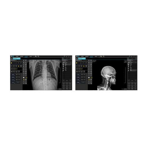 Software di visualizzazione DICOM - DRGEM  - di masterizzazione / per radiologia
