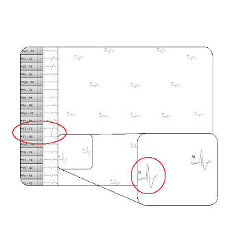 Software clinico - Net Station 5.4  - Electrical Geodesics - per EEG / da ricerca / di visualizzazione