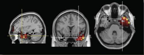 Software di visualizzazione - GeoSource 2.0 - Electrical Geodesics - medico / per EEG