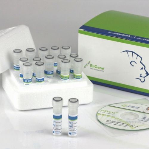 Kit di test per diagnosi COVID-19 - 90078-RT - Elisabeth Pharmacon spol  - SARS-COV-2 / clinico / di siero