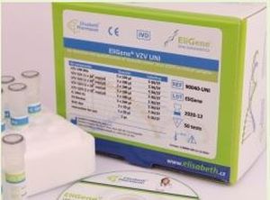 Kit di test dell'encefalite - EliGene® TBEV LC  - Elisabeth Pharmacon spol  - da ricerca / virale / clinico