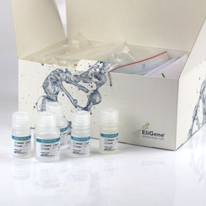 Kit di reagenti in soluzione - EliGene® - Elisabeth Pharmacon spol  - clinico / per campioni di saliva / per estrazione di DNA