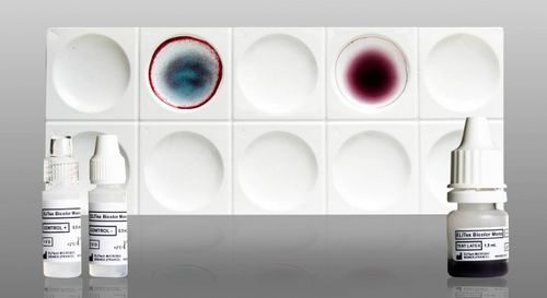 Test rapido della mononucleosi - ELITex Bicolor Mono - ELITech Group  - per anticorpi / del virus di Epstein-Barr / di sangue