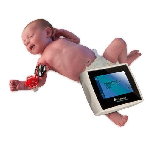 Analizzatore per fibrosi cistica neonatale - Macroduct® - ELITech Group  - per test del sudore