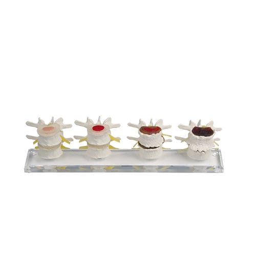 Modello anatomico di vertebre - 7577 - Erler-Zimmer - didattico / flessibile / in kit