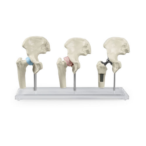 Modello anatomico di anca - 1115 - Erler-Zimmer - di articolazione / per implantologia / per chirurgia ortopedica