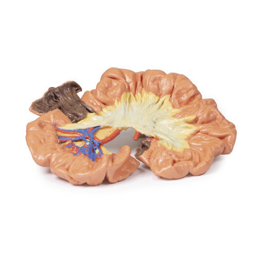 Modello anatomico di intestino - MP1725 - Erler-Zimmer - ad uso didattico