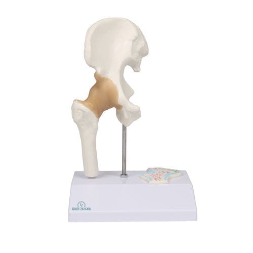 Modello anatomico di anca - 4523 - Erler-Zimmer - di articolazione / ad uso didattico / in miniatura