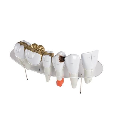 Modello anatomico di denti - R10125 - Erler-Zimmer - odontoiatrico / trasparente
