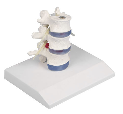 Modello anatomico di midollo spinale - 4047 - Erler-Zimmer - lombare / di dischi intervertebrali