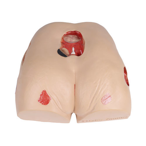 Simulatore di trattamento delle piaghe da decubito - 7600 - Erler-Zimmer - didattico / per assistenza generale / geriatrico