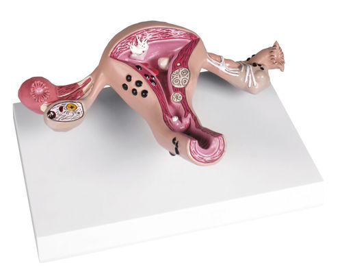 Modello anatomico cervicale - L262 - Erler-Zimmer - di utero / uterino / di collo dell’utero