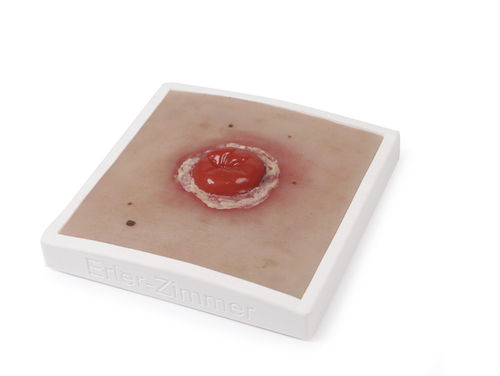 Simulatore di trattamento di ferite - PW022 - Erler-Zimmer - didattico / per cura di stomie / in plastica