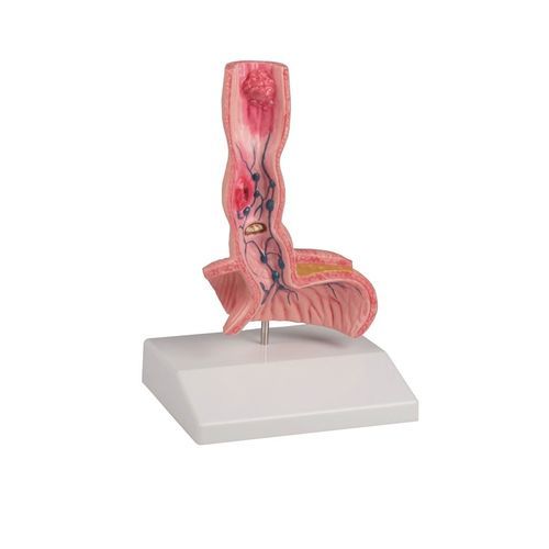 Modello anatomico di esofago - K218 - Erler-Zimmer