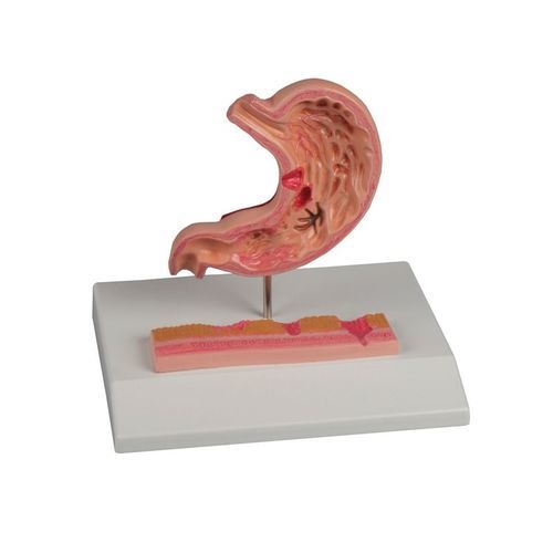 Modello anatomico di stomaco - K217 - Erler-Zimmer - di duodeno / di esofago