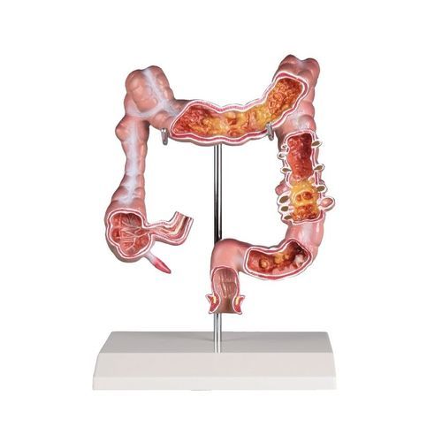 Modello anatomico di colon - K285 - Erler-Zimmer - ad uso didattico