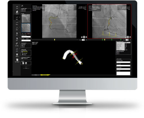 Software di analisi - CAAS WORKSTATION - Esaote - di visualizzazione / per angiografia