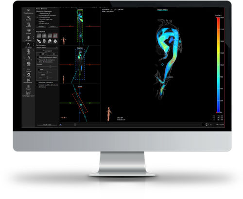 Software di analisi - CAAS MR - Esaote - MRI / medico