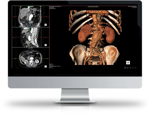 Software per diagnostica per immagini - SUITESTENSA RIS PACS - Esaote - medico / di visualizzazione / diagnostico