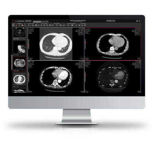 software per diagnostica per immagini - Esaote