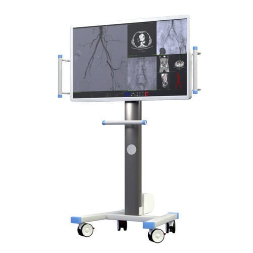 Monitor per diagnostica per immagini - Eurocolumbus - 4K / 55" / portatile