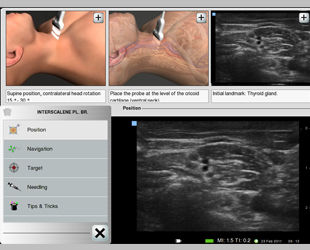 Software di gestione - Cue Card - eZono - medico / per ecografia