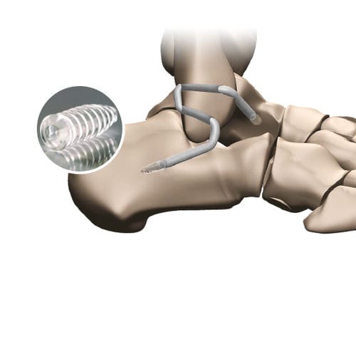 Protesi di legamento tendine gracile - 267 596 - FH Orthopedics - sintetica