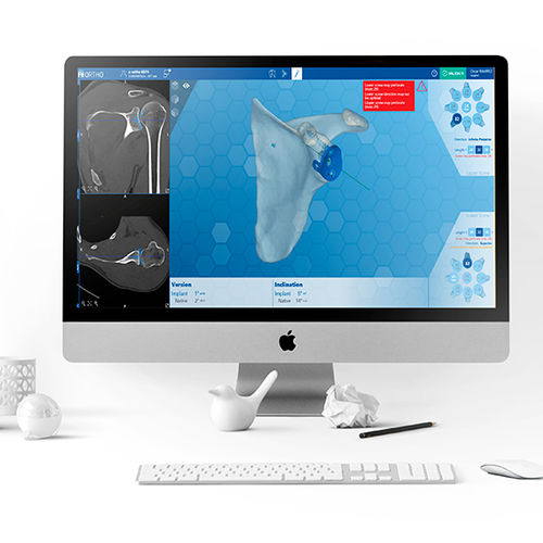 Software per chirurgia della spalla - e-Ortho - FH Orthopedics - di anatomia / per tomografia computerizzata / preoperatorio