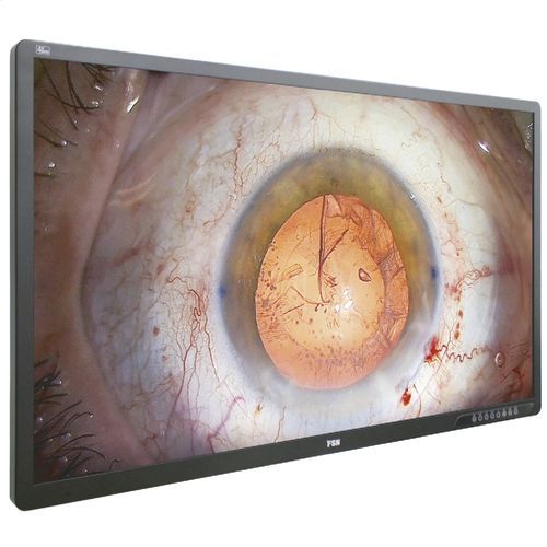 Monitor medico - FM-A5505DGC - FSN Medical Technologies - per endoscopia / chirurgico / Full HD